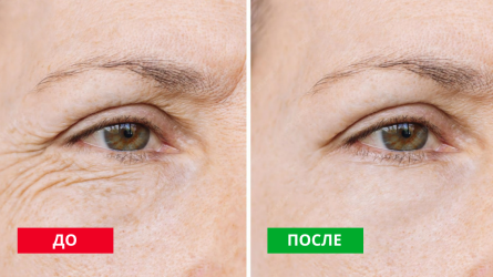 Фото «до и после»: самый недооценённый инструмент медицинского маркетинга Фото «до и после»: самый недооценённый инструмент медицинского маркетинга